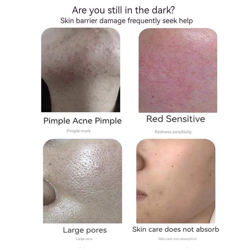 Conjunto de pó liofilizado com - Oligopeptide Wrinkle avaliação e preço